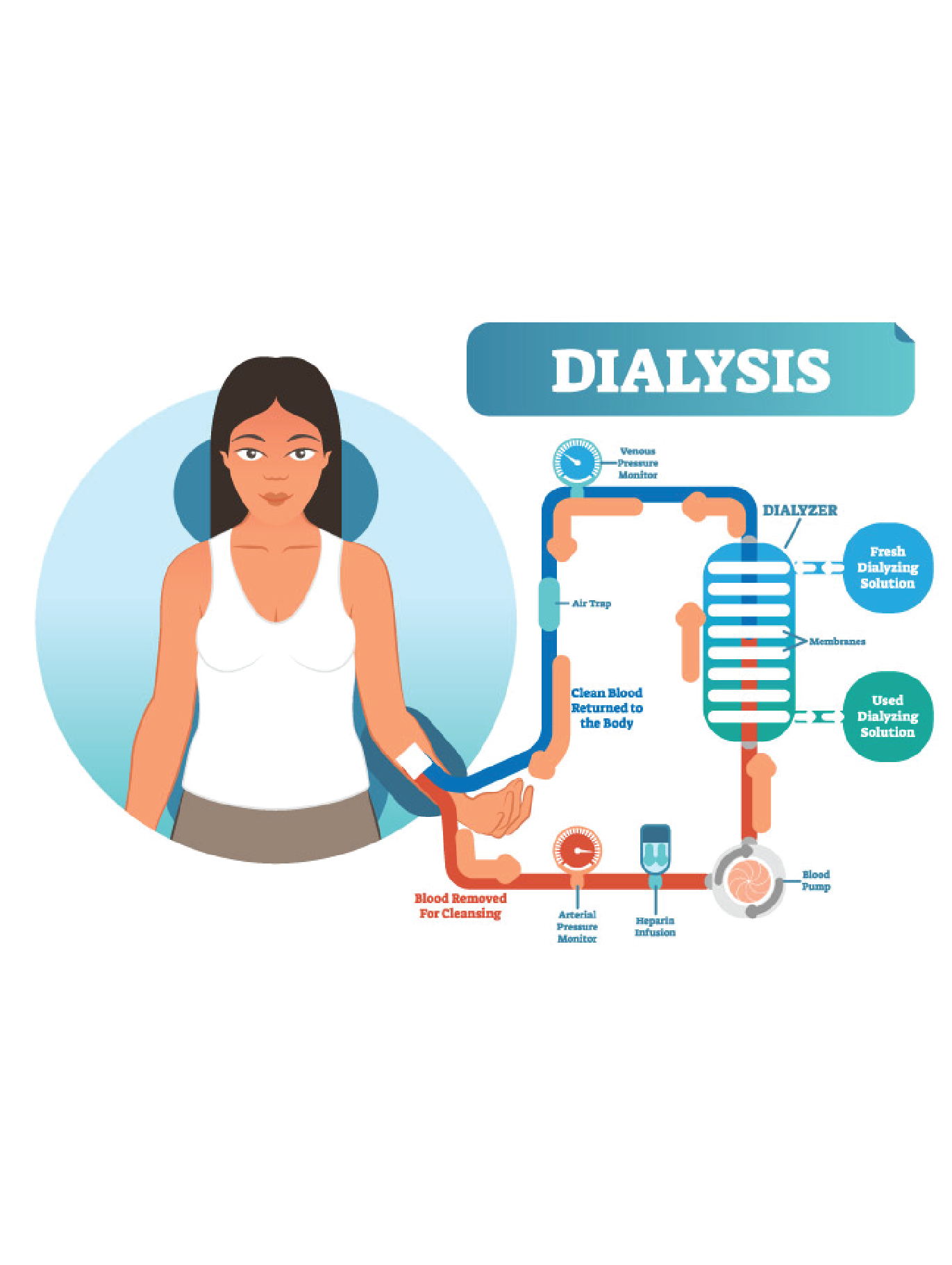 Kidney Dialysis